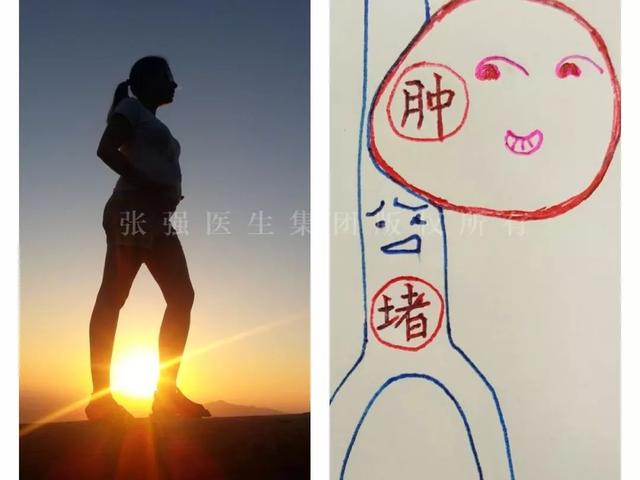 [你的育儿经]「鼠年“鼠你好孕”」做到这3点，让你轻松应对孕期下肢静脉曲张