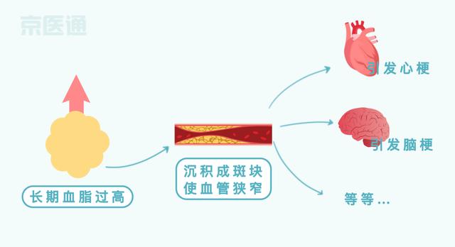 高血压|血压、血糖、血脂…标准对照表来了！还有忌口清单，快收好