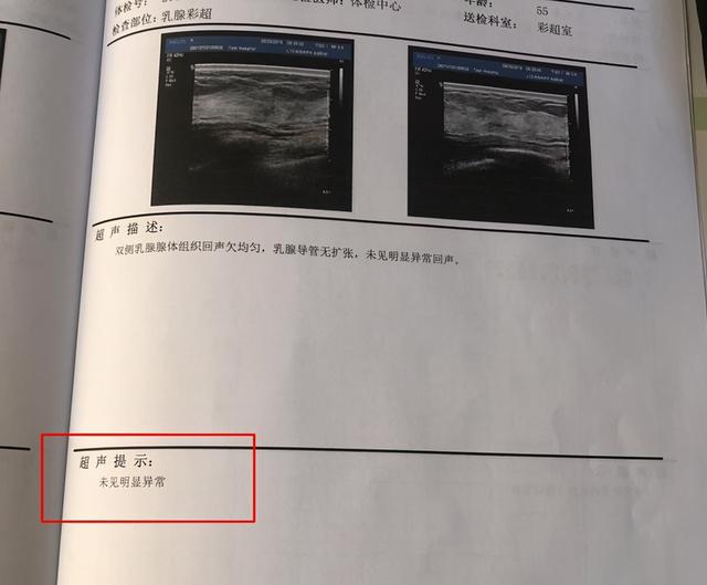 乳腺结节患者，结节小不能手术，选择中医治疗2个月结节消失了