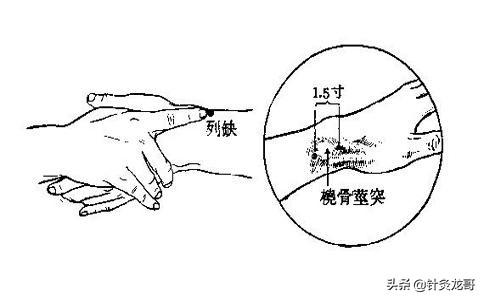 十二正经上的八脉交会穴通于奇经八脉，是灵龟八法的基础穴位