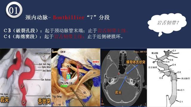 头颈动脉系统相关解剖