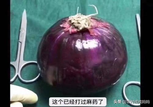 [你的育儿经]产妇老公说，剖腹产就如同睡一觉，遭到别人责备后摔门而去