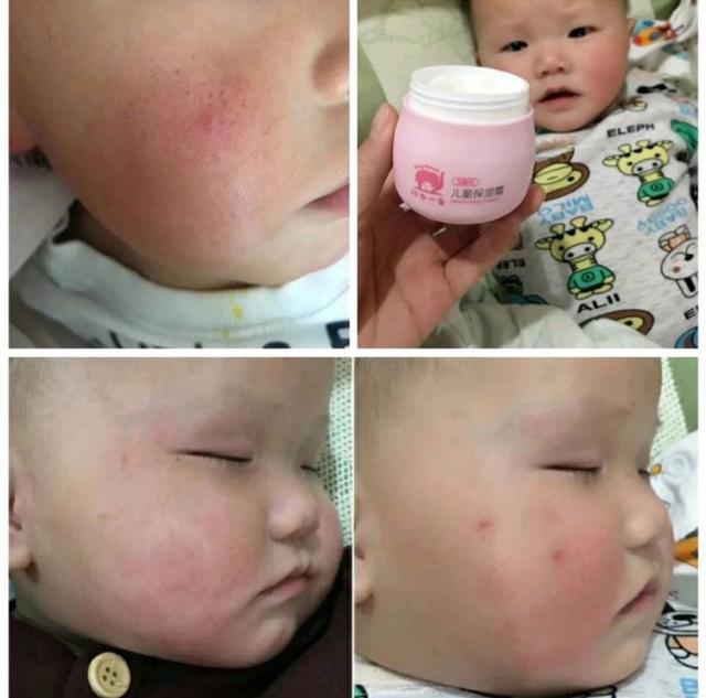「你的育儿经」5秒钟卖出去2.8万瓶的面霜,薇娅极力推荐,林志颖:小小志也在用
