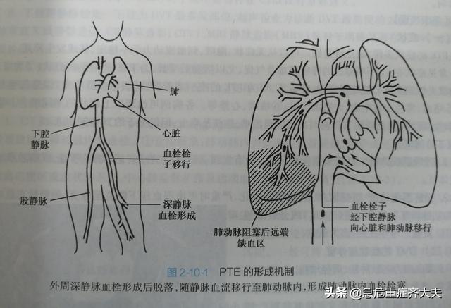 右心室|久坐也会致命？不知此病要出大问题