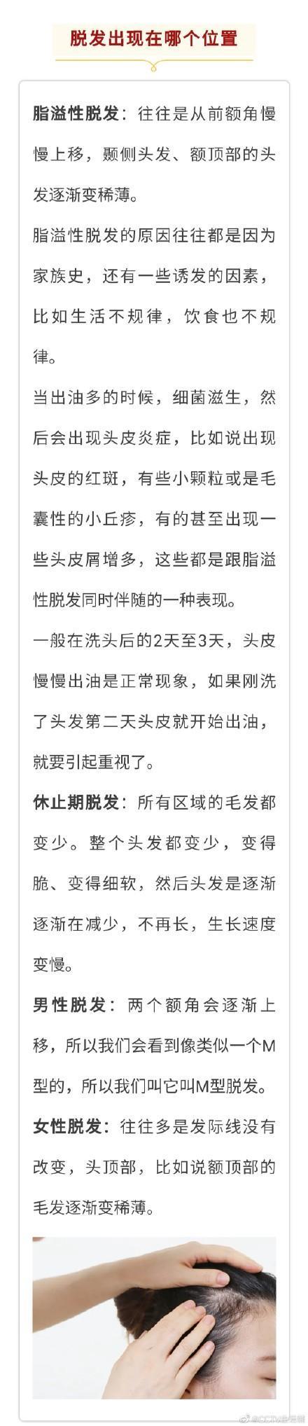 脱发|2.5亿人的困扰！记住这6点帮你拯救
