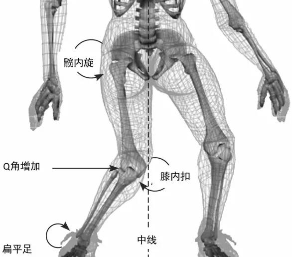 膝关节疼痛、经常打软腿？一种自测方法找原因，四个动作练起来