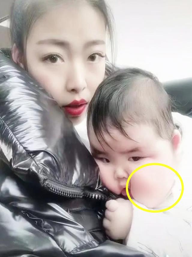 你的育儿经|新生宝宝饮食无节制，脸胖得变形，网友：“蜡笔小新”同款脸型