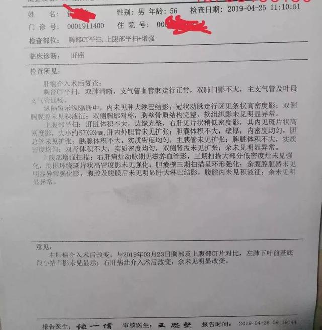 中药治肝癌肿瘤，一疗程后肿瘤开始缩小