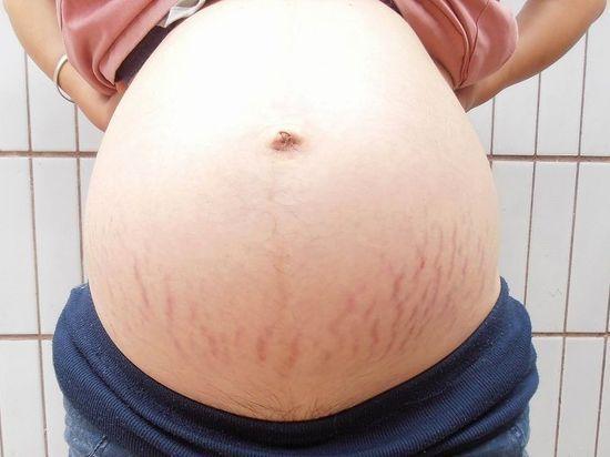 「超级宝妈」孕妇肚子上面的“黑线”是什么？别担心，原来是这样的
