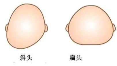 超级宝妈▲“脑勺高,聪明包”,宝宝头型与智商挂钩?家长们别再被误导了