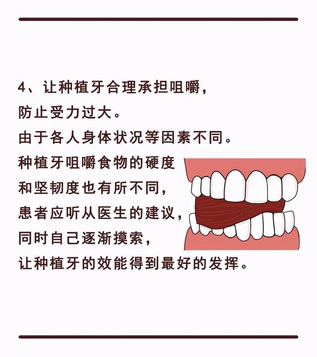 “种植牙”术后如何护理？有哪些注意事项？