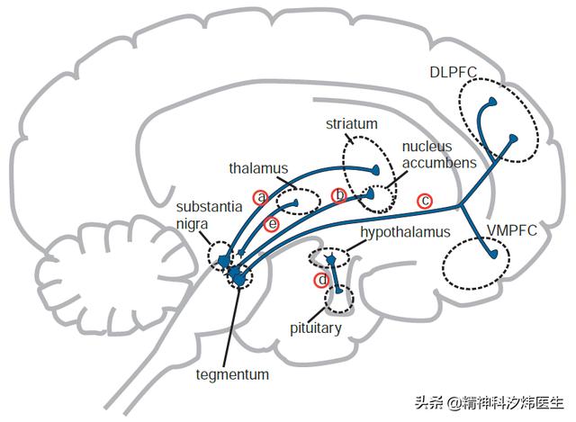 闭经、溢乳！医生带你了解：部分抗精神病药物导致的高催乳素血症