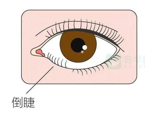 超级宝妈|你家孩子的眼睛还好吗？眼科专家传授鉴别法和小妙招