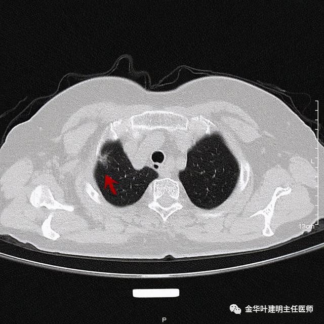 如此违反原则的手术方案设计，你支持吗？
