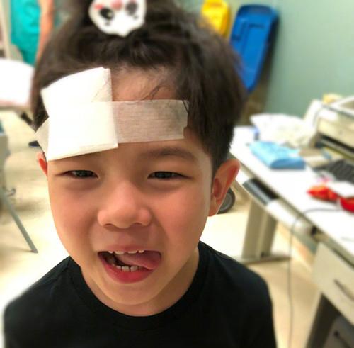 你的育儿经@1.5岁女宝意外磕伤额头，缝5针留大疤，保护宝宝从家庭意外开始