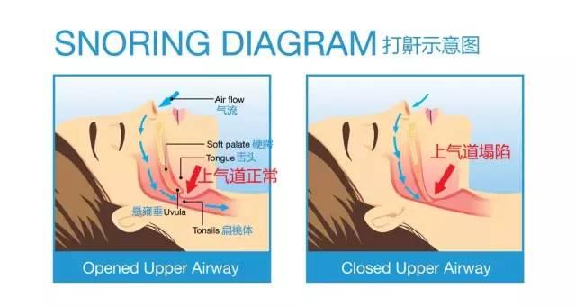 身体|睡觉时为什么总被“抖醒”？还有这些现象也不容忽视