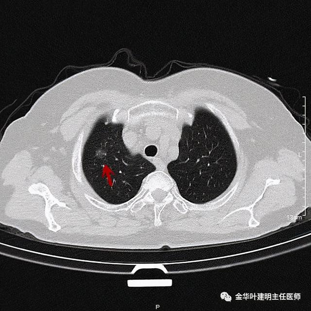 如此违反原则的手术方案设计，你支持吗？