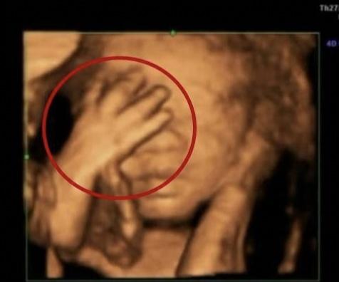 [你的育儿经]去产检，竟看到宝宝在肚子里“数数”，孕妈：看来胎教还是有用的