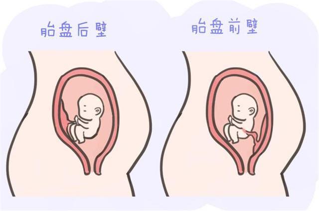 甜蜜妈妈|胎盘位置就能看出胎儿性别？不如抛开迷信，看看科学能判断什么