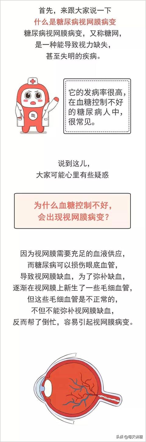 糖尿病并发症眼睛模糊怎么办？防治的关键在这里