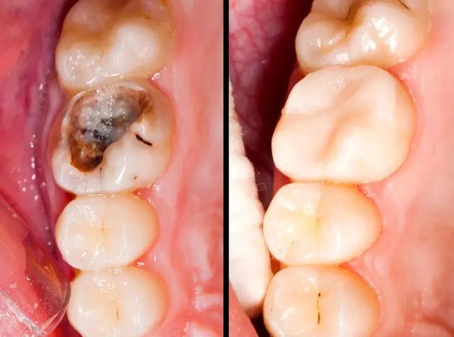 它是人体中最「硬」的组织，越早重视越省钱