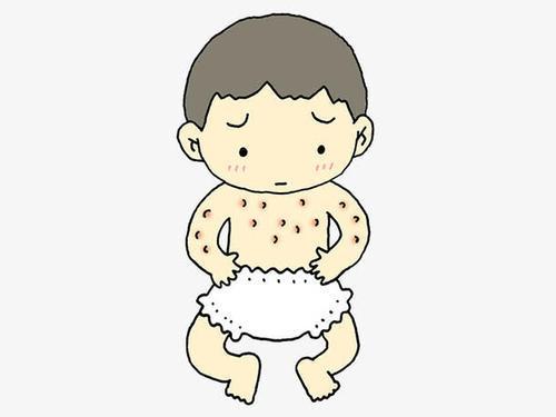 超级宝妈▲春季宝宝爱过敏，除了远离致敏因素，这几招妈妈也要知道