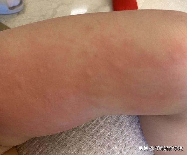 「超级宝妈」崔玉涛：有娃请当心，过度消毒后遗症来了