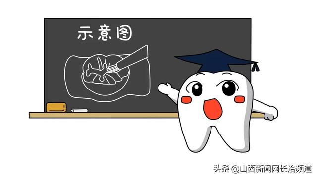 超级宝妈|长兴口腔六一儿童节福利，快带孩子来免费做窝沟封闭吧