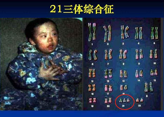 超级宝妈|“一回生二回熟，二胎不用每次都产检”，真不是！这6项一定要查