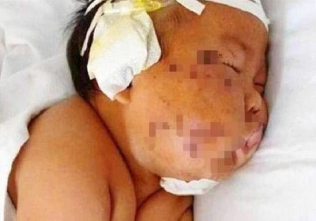 「超级宝妈」5年前因吃奶太用力，被妈妈戳伤脸的那个男孩，现状令人意外