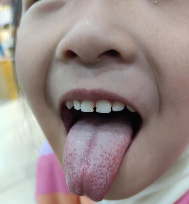 [你的育儿经]你的脾胃健康吗？