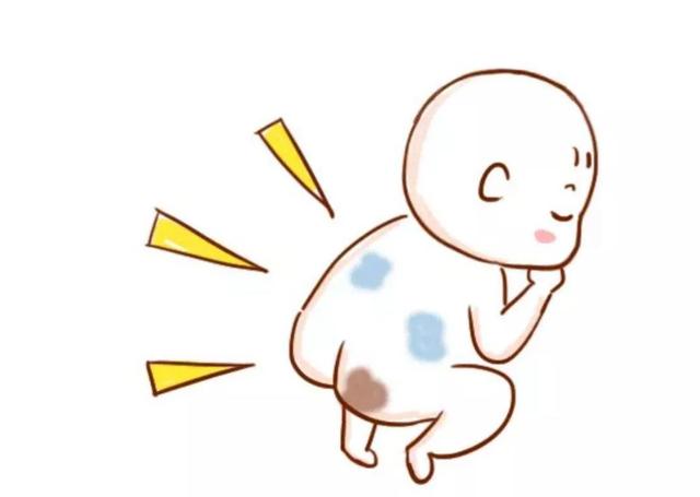#你的育儿经#宝宝出生后屁股上的青斑是什么？