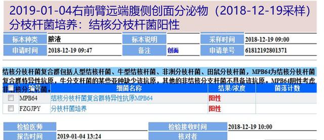 青年女子伤口狰狞、半年不愈，涂片检查发现元凶竟然是它……