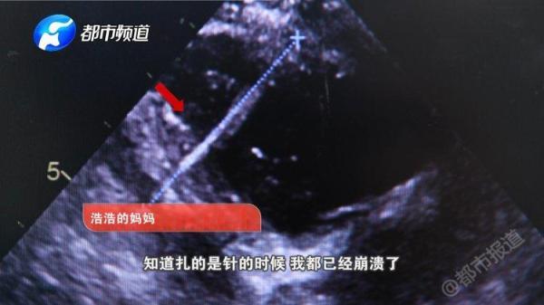 「光明网」扎心了！一岁宝宝心脏扎绣花针，凶手就在家里