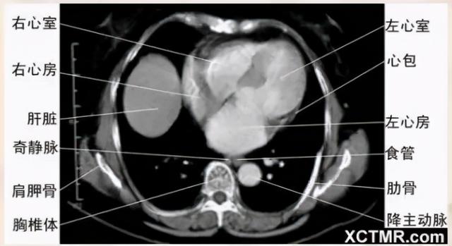影像解剖：胸、腹部、盆腔CT解剖