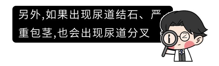 正常情况下，男人应该站着尿还是坐着尿？不尿到马桶外很难吗？