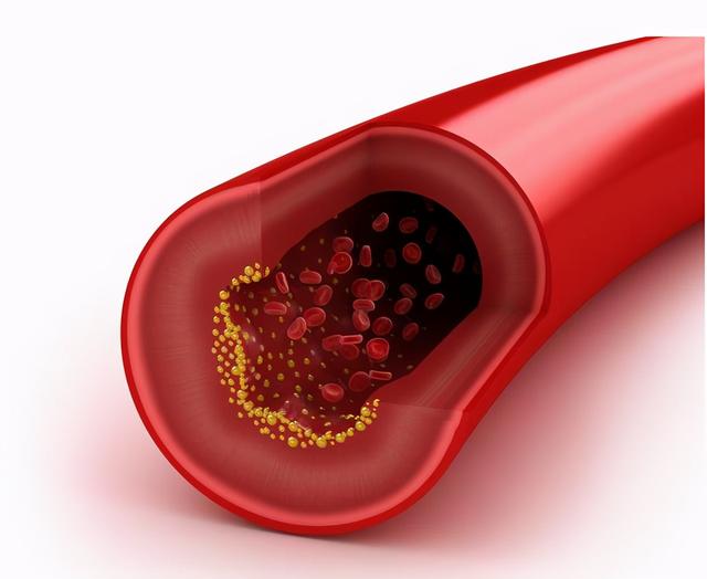 哪些人应定期检查血脂水平？（原创）