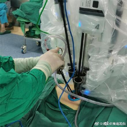 单孔|单孔新纪元！江西完成首例单孔机器人肺癌根治术