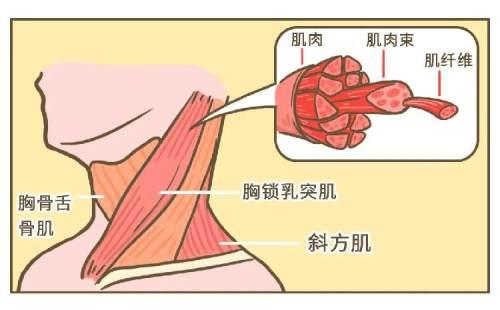 落枕可能是身体的「求救信号」，别不当回事