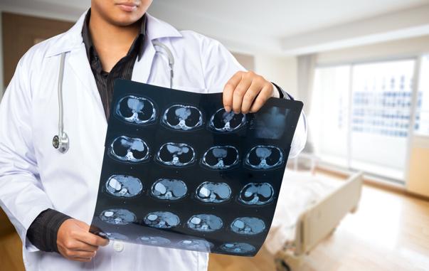 肝病越来越多？医生：3种蔬菜或"悄悄"损伤肝脏，劝你尽量少吃