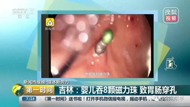芒果都市|这种“益智玩具”你家有吗？千万不要给孩子购买……