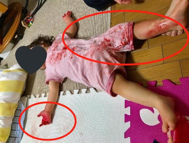 #你的育儿经#妈妈出门取快递，回来后的一幕让她崩溃：女儿躺在大片“血泊”中