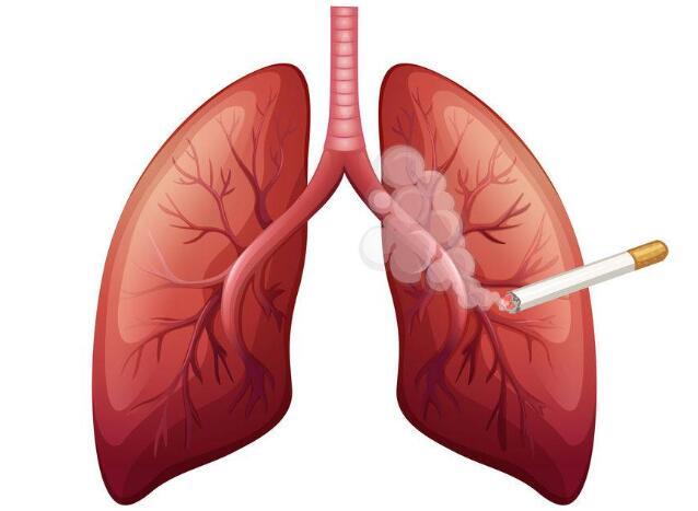 肺癌“偏爱”这4类人，若你符合，需注意加强养护肺脏，定期检查