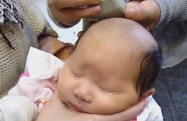 「你的育儿经」奶奶带孩子剃“满月头”，结果娃的头发再没长出来，医生：瞎胡闹