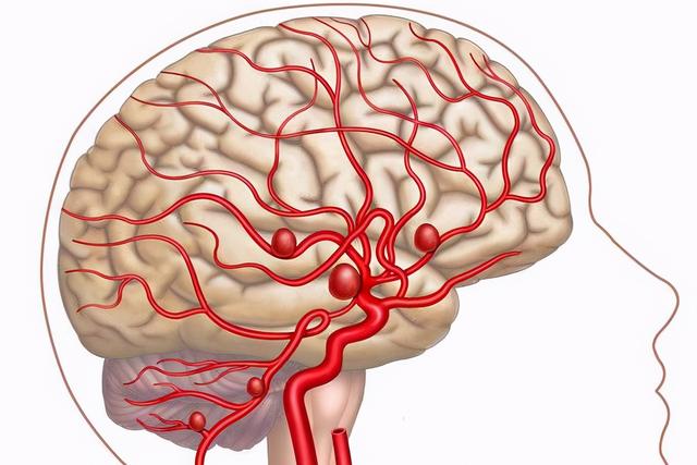 脑血管出现“硬化”，人体6个表现藏不住，先自查