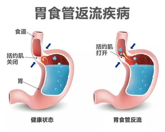 消化不好，吃啥都难受，做到这15点，提高你的消化能力