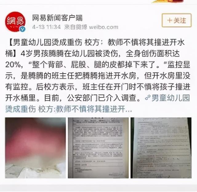 “我的孩子才4岁，却在学校被烫得血肉模糊。”