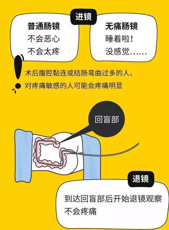 肠镜检查到底是什么体验？检查前怎么准备肠道？