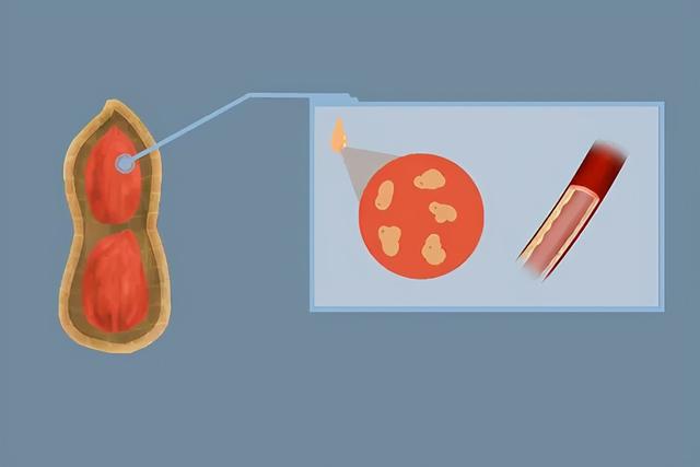肝癌“催化剂”被发现，可能就藏在身边，别蒙在鼓里，早点处理