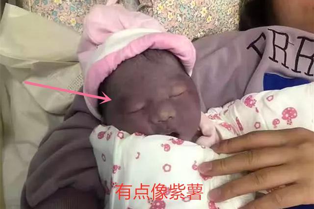 超级宝妈@女儿出生时灰头土脸，被质疑“不是亲生的”，2个月后成功逆袭